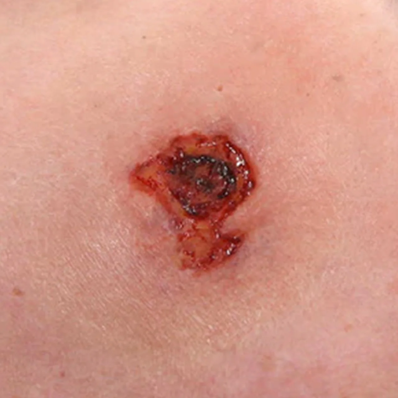 Bullet Hole Molds Entry .45 Calliber - Image 3