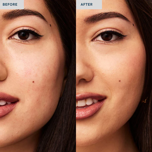 Invisible Spot Fix - Image 12