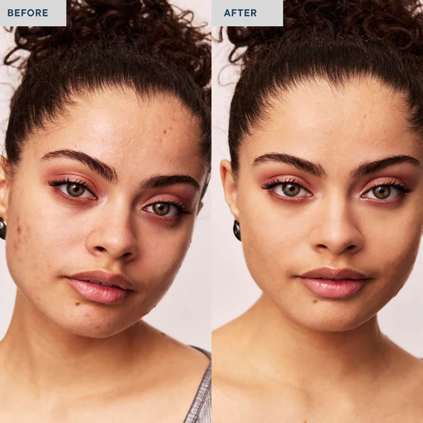 Invisible Spot Fix - Image 13