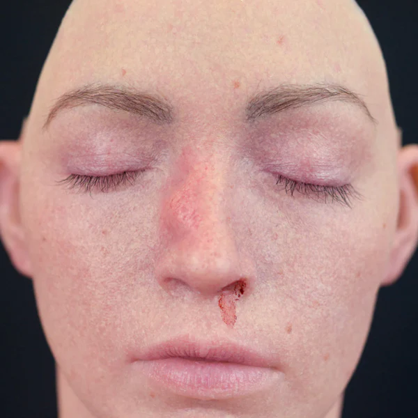 Peel N' Stick Prosthetics, Broken Nose - Image 3
