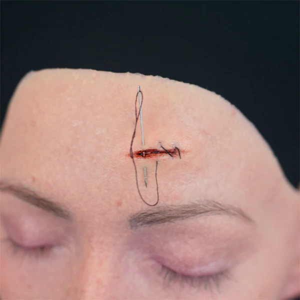 Peel N' Stick Prosthetics, Stitchable Wound (Small) - Image 3