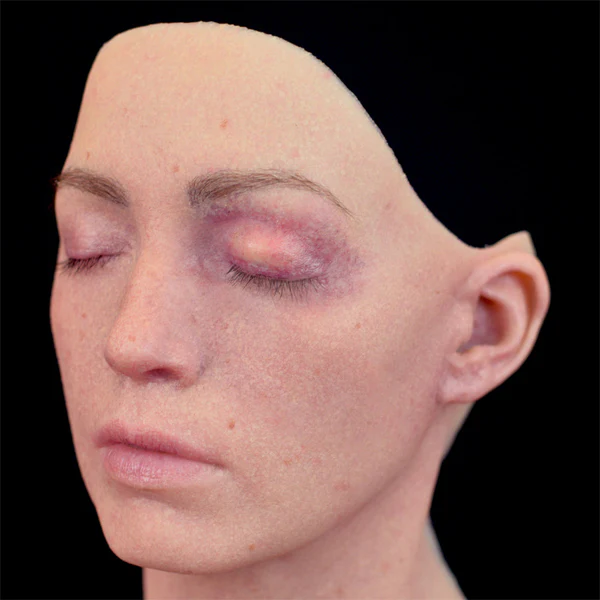 Peel N' Stick Prosthetics, Swollen Upper Eyelid 3 - Image 3