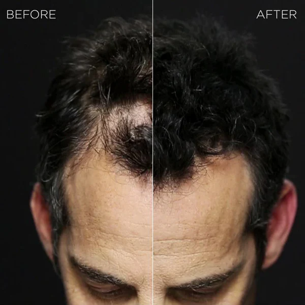 Hair Building Fibers - Image 5